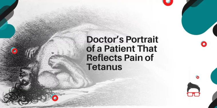 Doctor’s Portrait of a Patient That Reflects Pain of Tetanus